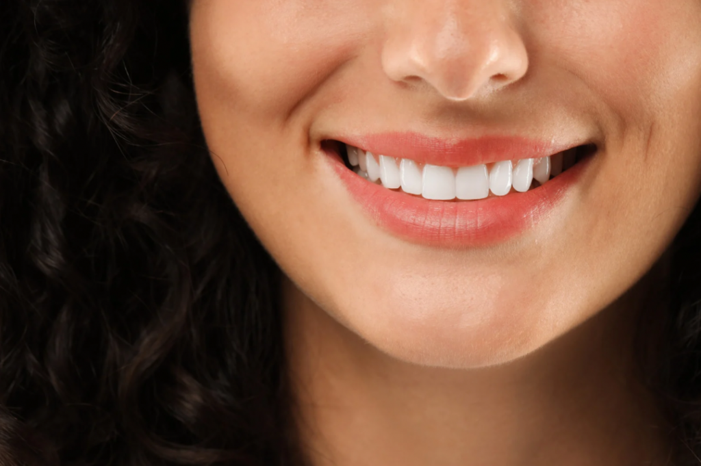 Veneers in Red Bank NJ