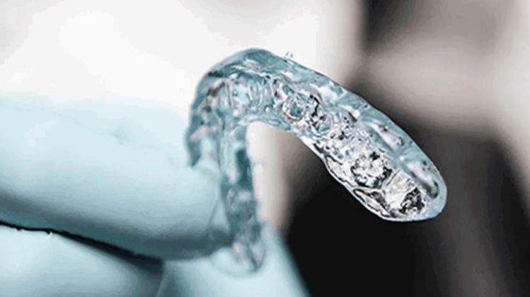 Invisalign vs Traditional Braces