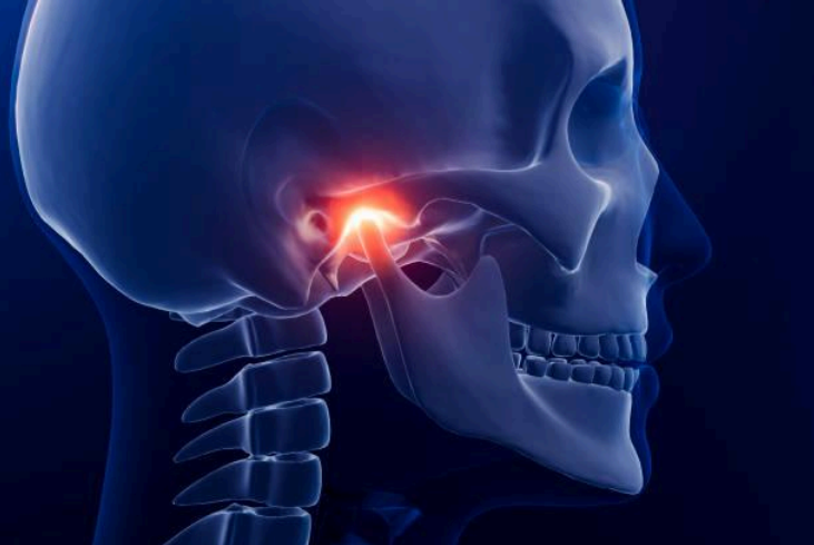 TMJ Treatment